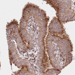 Invitrogen COMMD3 Polyclonal Antibody 100 &mu;L; Unconjugated:Antibodies,