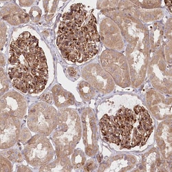 Invitrogen COMMD3 Polyclonal Antibody 100 &mu;L; Unconjugated:Antibodies,