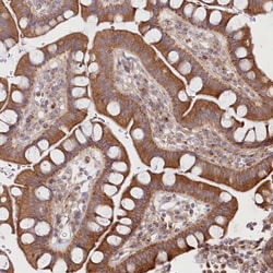 Invitrogen COMMD3 Polyclonal Antibody 100 &mu;L; Unconjugated:Antibodies,