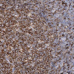 PIWIL4 Polyclonal Antibody:Antibodies, Polyclonal