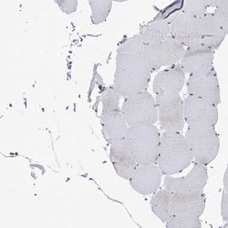 Invitrogen DDX21 Polyclonal Antibody 100 &mu;L; Unconjugated:Antibodies,