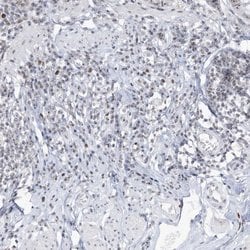 Invitrogen DDX21 Polyclonal Antibody 100 &mu;L; Unconjugated:Antibodies,