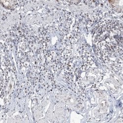 Invitrogen DDX21 Polyclonal Antibody 100 &mu;L; Unconjugated:Antibodies,