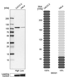 Invitrogen DDX21 Polyclonal Antibody 100 &mu;L; Unconjugated:Antibodies,
