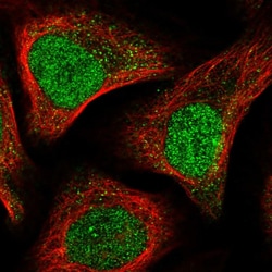 Invitrogen APC15 Polyclonal Antibody 100 &mu;L; Unconjugated:Antibodies,