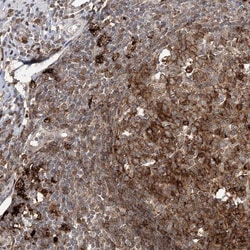 Invitrogen APC15 Polyclonal Antibody 100 &mu;L; Unconjugated:Antibodies,