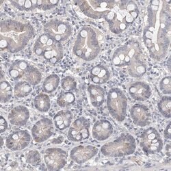 Invitrogen DPCD Polyclonal Antibody 100 &mu;L; Unconjugated:Antibodies,