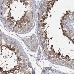 Invitrogen DPCD Polyclonal Antibody 100 &mu;L; Unconjugated:Antibodies,