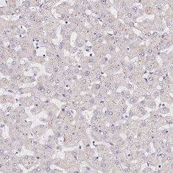 Invitrogen PPP2R5B Polyclonal Antibody 100 &mu;L | Buy Online | Invitrogen&trade; | Fisher Scientific