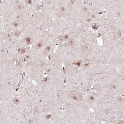 Invitrogen PPP2R5B Polyclonal Antibody 100 &mu;L | Buy Online | Invitrogen&trade; | Fisher Scientific