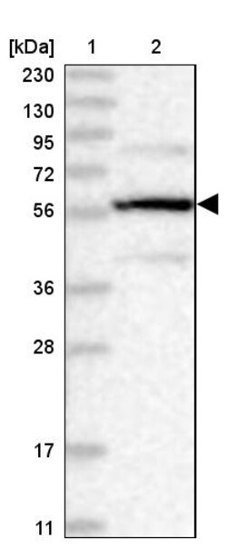 Invitrogen PPP2R5B Polyclonal Antibody 100 &mu;L | Buy Online | Invitrogen&trade; | Fisher Scientific