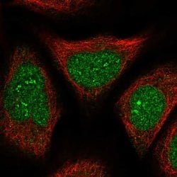 Invitrogen FAM76B Polyclonal Antibody 100 &mu;L; Unconjugated:Antibodies,