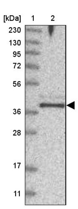 Invitrogen FAM76B Polyclonal Antibody 100 &mu;L | Buy Online | Invitrogen&trade; | Fisher Scientific