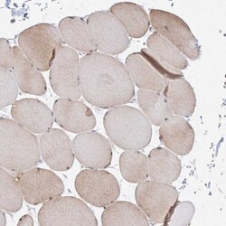 Invitrogen ARHGAP21 Polyclonal Antibody 100 &mu;L; Unconjugated:Antibodies,