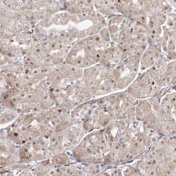 Invitrogen ARHGAP21 Polyclonal Antibody 100 &mu;L; Unconjugated:Antibodies,