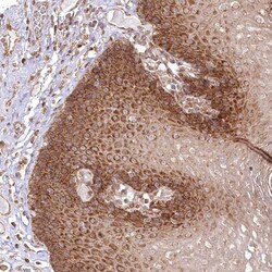 Invitrogen OTUD4 Polyclonal Antibody 100 &mu;L; Unconjugated:Antibodies,