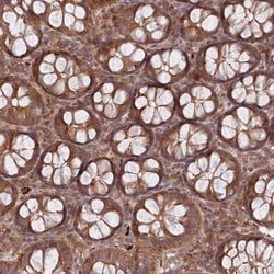 Invitrogen ABHEB Polyclonal Antibody 100 &mu;L; Unconjugated:Antibodies,