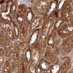 Invitrogen ABHEB Polyclonal Antibody 100 &mu;L; Unconjugated:Antibodies,