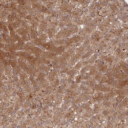 Invitrogen ABHEB Polyclonal Antibody 100 &mu;L; Unconjugated:Antibodies,