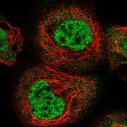 Invitrogen RBM15B Polyclonal Antibody 100 &mu;L; Unconjugated:Antibodies,