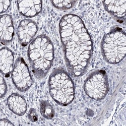 Invitrogen RBM15B Polyclonal Antibody 100 &mu;L; Unconjugated:Antibodies,