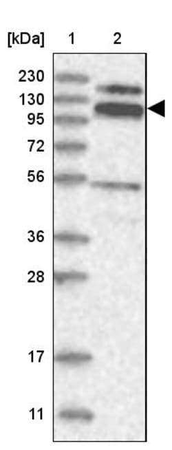 Invitrogen RBM15B Polyclonal Antibody 100 &mu;L; Unconjugated:Antibodies,