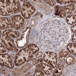 GRPEL1 Polyclonal Antibody:Antibodies, Polyclonal