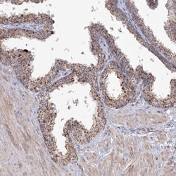 GRPEL1 Polyclonal Antibody:Antibodies, Polyclonal