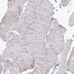 GRPEL1 Polyclonal Antibody:Antibodies, Polyclonal