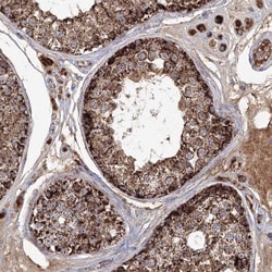 GRPEL1 Polyclonal Antibody:Antibodies, Polyclonal