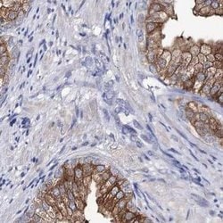 Invitrogen UGDH Polyclonal Antibody 100 &mu;L; Unconjugated:Antibodies,