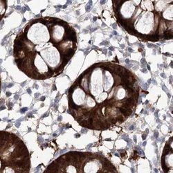 Invitrogen UGDH Polyclonal Antibody 100 &mu;L; Unconjugated:Antibodies,