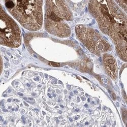 Invitrogen UGDH Polyclonal Antibody 100 &mu;L; Unconjugated:Antibodies,