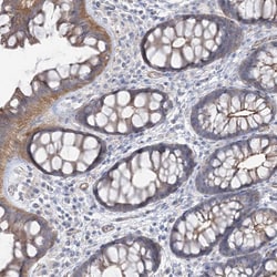Invitrogen PIGC Polyclonal Antibody 100 &mu;L; Unconjugated:Antibodies,