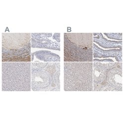 Invitrogen LRP2BP Polyclonal Antibody 100 &mu;L; Unconjugated:Antibodies,