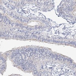 Invitrogen LRP2BP Polyclonal Antibody 100 &mu;L; Unconjugated:Antibodies,