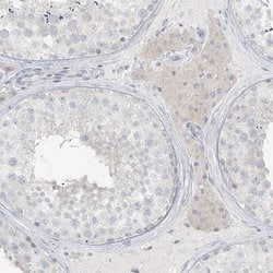 Invitrogen LRP2BP Polyclonal Antibody 100 &mu;L; Unconjugated:Antibodies,