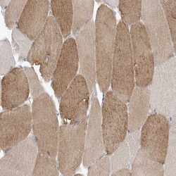 Invitrogen FARSB Polyclonal Antibody 100 &mu;L; Unconjugated:Antibodies,