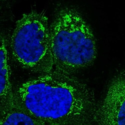 SUCLG1 Polyclonal Antibody:Antibodies, Polyclonal