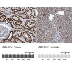 SUCLG1 Polyclonal Antibody:Antibodies, Polyclonal