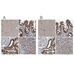 SUCLG1 Polyclonal Antibody:Antibodies, Polyclonal