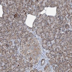SUCLG1 Polyclonal Antibody:Antibodies, Polyclonal