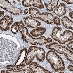 SUCLG1 Polyclonal Antibody:Antibodies, Polyclonal
