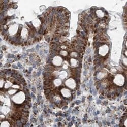 SUCLG1 Polyclonal Antibody:Antibodies, Polyclonal