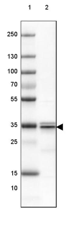 Invitrogen SUCLG1 Polyclonal Antibody 100 &mu;L; Unconjugated:Antibodies,