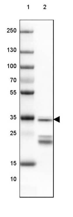 Invitrogen SUCLG1 Polyclonal Antibody 100 &mu;L; Unconjugated:Antibodies,