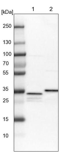 Invitrogen SUCLG1 Polyclonal Antibody 100 &mu;L; Unconjugated:Antibodies,