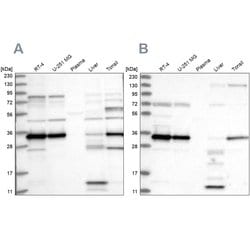 SUCLG1 Polyclonal Antibody:Antibodies, Polyclonal