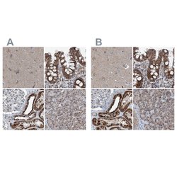 Invitrogen SUCLG1 Polyclonal Antibody 100 &mu;L; Unconjugated:Antibodies,