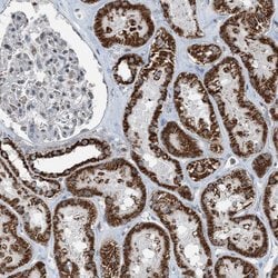 Invitrogen SUCLG1 Polyclonal Antibody 100 &mu;L; Unconjugated:Antibodies,